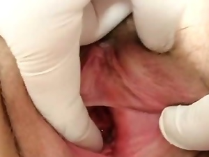 Hairy grandma enema during a medical exam